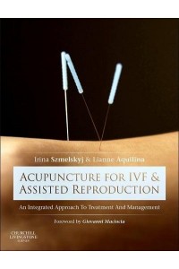 Acupuncture for IVF and Assisted Reproduction An Integrated Approach to Treatment and Management