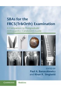 SBAs for the FRCS (Tr & Orth) Examination A Companion to Postgraduate Orthopaedics Candidate's Guide
