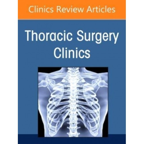 Esophageal Cancer, an Issue of Thoracic Surgery Clinics Volume 32-4 - Clinics: Internal Medicine