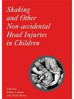 Shaking and Other Non-Accidental Head Injuries in Children - Clinics in Developmental Medicine
