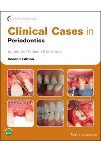 Clinical Cases in Periodontics - Clinical Cases (Dentistry)